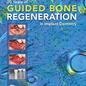 ۲۰Years of Guided Bone Regeneration in Implant Dentistry