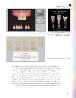 2_Page_13 رنگ در دندانپزشکی (راهنمای کلینیکی برای زیبایی پیش بینی پذیر) گلاسه رنگی - Image 9