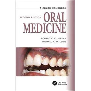 A Color Handbook Oral Medicine
