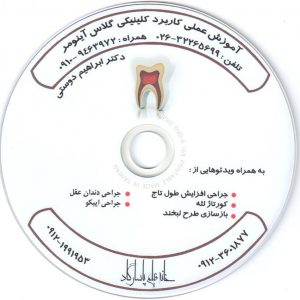 آموزش عملی کاربرد کلینیکی گلاس آینومر CD-DVD