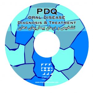 تشخیص بیماری های دهان PDQ