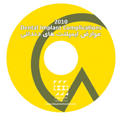عوارض ایمپلنت های دندانی CD-PDF