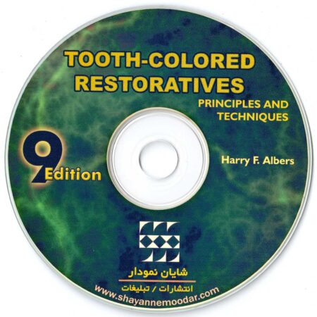 CD ترمیم های هم رنگ دندان-TRC