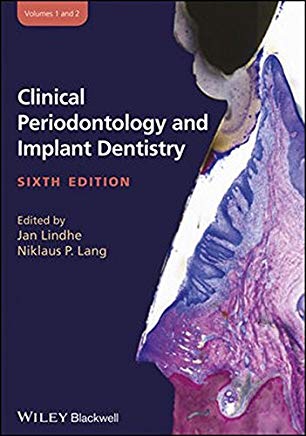 (Clinical Periodontology and Implant Dentistry Lindhe (2 Vol
