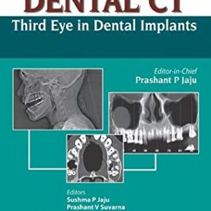 DENTAL CT Third Eye in Dental Implants