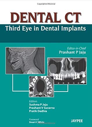 DENTAL CT Third Eye in Dental Implants