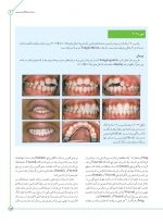 درمان زود هنگام ارتودنسی - Image 10