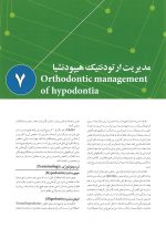 درمان زود هنگام ارتودنسی - Image 11