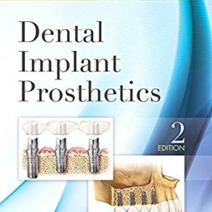 Dental implant prostodontics