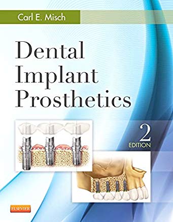 Dental implant prostodontics