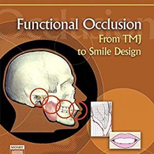 Functional Occlusion From TMJ to Smile Design