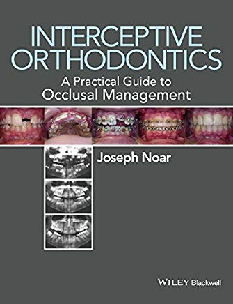 Interceptive Orthodontics A Practical Guide to Occlusal Management