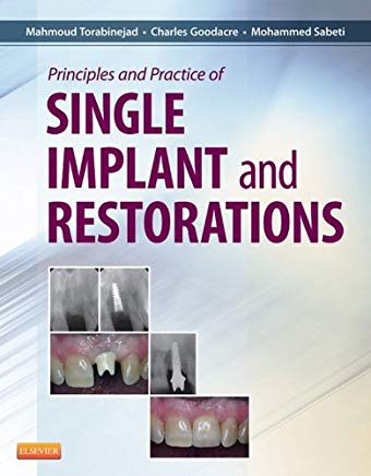 Principle and Practice of Single Implant and Restoration