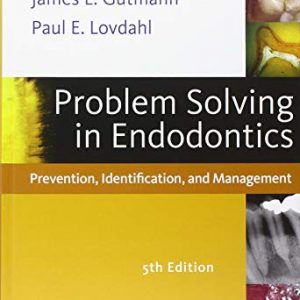 Problem Solving in Endodontics Prevention, Identiﬁcation, and Management