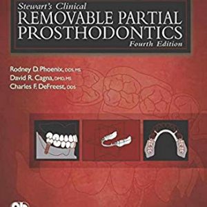 Stewart’s Clinical Removable Partial Prosthodntics