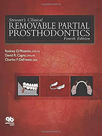 Stewart’s Clinical Removable Partial Prosthodntics