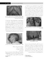 پاتولوژی دهان، فک و صورت نویل ۲۰۱۶ جلد ۱ (سیاه و سفید) - Image 6