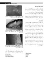 nevli 2_Page_07 پاتولوژی دهان، فک و صورت نویل ۲۰۱۶ جلد ۲ (سیاه و سفید) - Image 8