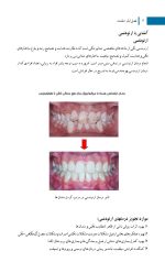 آشنایی مقدماتی با ارتودنسی (وسایل و واژه های رایج در این علم) - Image 6