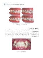 آشنایی مقدماتی با ارتودنسی (وسایل و واژه های رایج در این علم) - Image 9