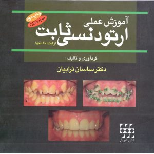 آموزش عملی ارتودنسی ثابت از ابتدا تا انتها