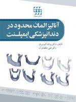 آنالیز المان محدود در دندانپزشکی ایمپلنت