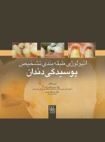 اتیولوژی/طبقه بندی/تشخیص پوسیدگی دندان