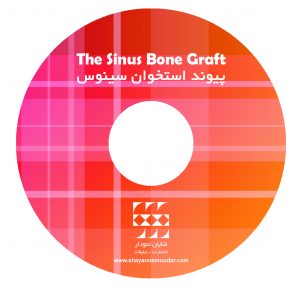 پیوند استخوان سینوس CD-PDF