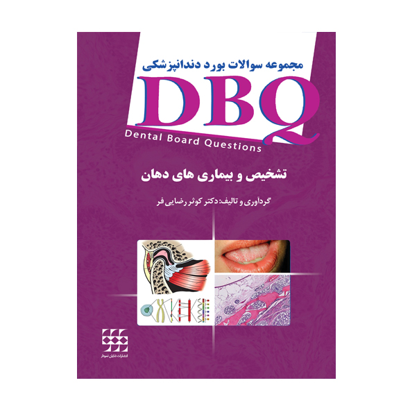 DBQ تشخیص و بیماری های دهان
