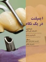 ایمپلنت در یک نگاه