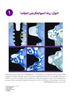 ایمپلنت در یک نگاه_Page_06 ایمپلنت در یک نگاه - Image 6