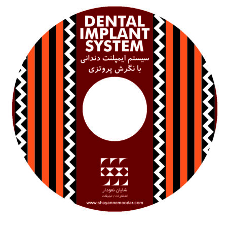 سیستم ایمپلنت دندانی با نگرش پروتزی CD-VCD