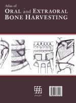 بازسازی استخوان دهان، فک و صورت - Image 2