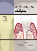 بیماریهای اطراف ایمپلنت