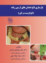 بازسازی تاج دندان های از بین رفته (انواع پست و کور) - رنگی