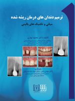 ترمیم دندان های درمان ریشه شده (مبانی تکنیک های بالینی)