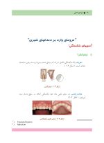 ترومای دندانی - Image 4