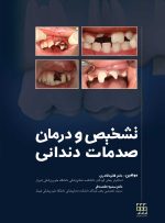 تشخیص و درمان صدمات دندانی