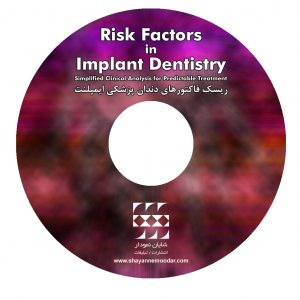 ریسک فاکتورهای دندانپزشکی ایمپلنت