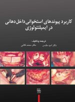 کاربرد پیوندهای استخوانی داخل دهانی در ایمپلنتولوژی