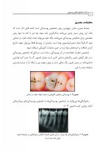 لذت دندانپزشکی ترمیمی - Image 10