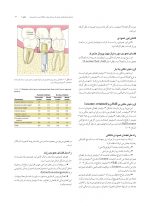 مشكلات جراحى ايمپلنت_Page_07 مشکلات جراحی ایمپلنت (علت، پیشگیری و درمان) - Image 7