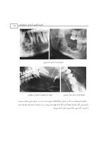 اطلس رادیولوژی دهان و فک و صورت - Image 5
