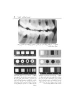 ضروریات رادیوگرافی دندانپزشکی - Image 9