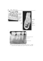ضروریات رادیوگرافی دندانپزشکی - Image 11