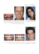 اصول کاربردی آموزش گام به گام پرسلن لامینیت ونیر (۲ جلدی) - Image 7