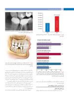 پروتز ایمپلنت های دندانی میش ۲۰۱۵ ( گلاسه رنگی دوجلدی همراه با قاب) - Image 10