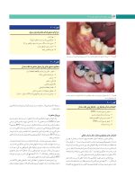 پروتز ایمپلنت های دندانی میش ۲۰۱۵ ( گلاسه رنگی دوجلدی همراه با قاب) - Image 14