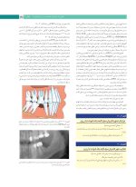 پروتز ایمپلنت های دندانی میش ۲۰۱۵ ( گلاسه رنگی دوجلدی همراه با قاب) - Image 15