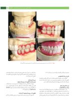 پروتز ایمپلنت های دندانی میش ۲۰۱۵ ج ۲ (سیاه و سفید) - Image 9